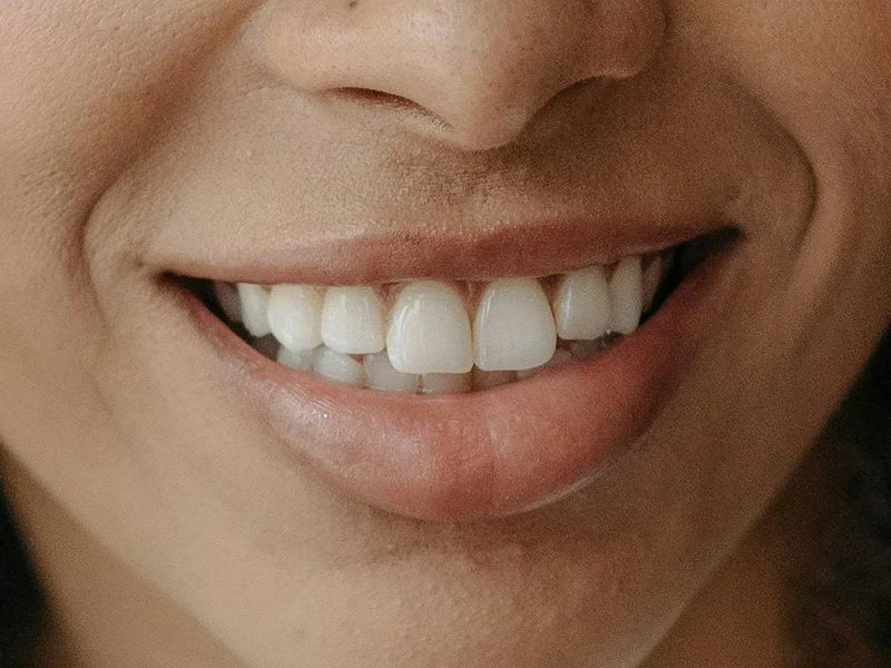 Does Teeth Whitening Damage Enamel?