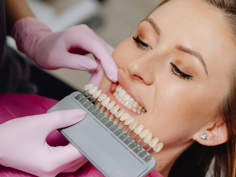 Teeth Whitening Procedure: At Home VS In-Office